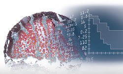 Tissue-Phenomics-Image-definiens-1