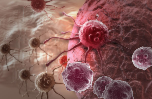 Hematological cancers