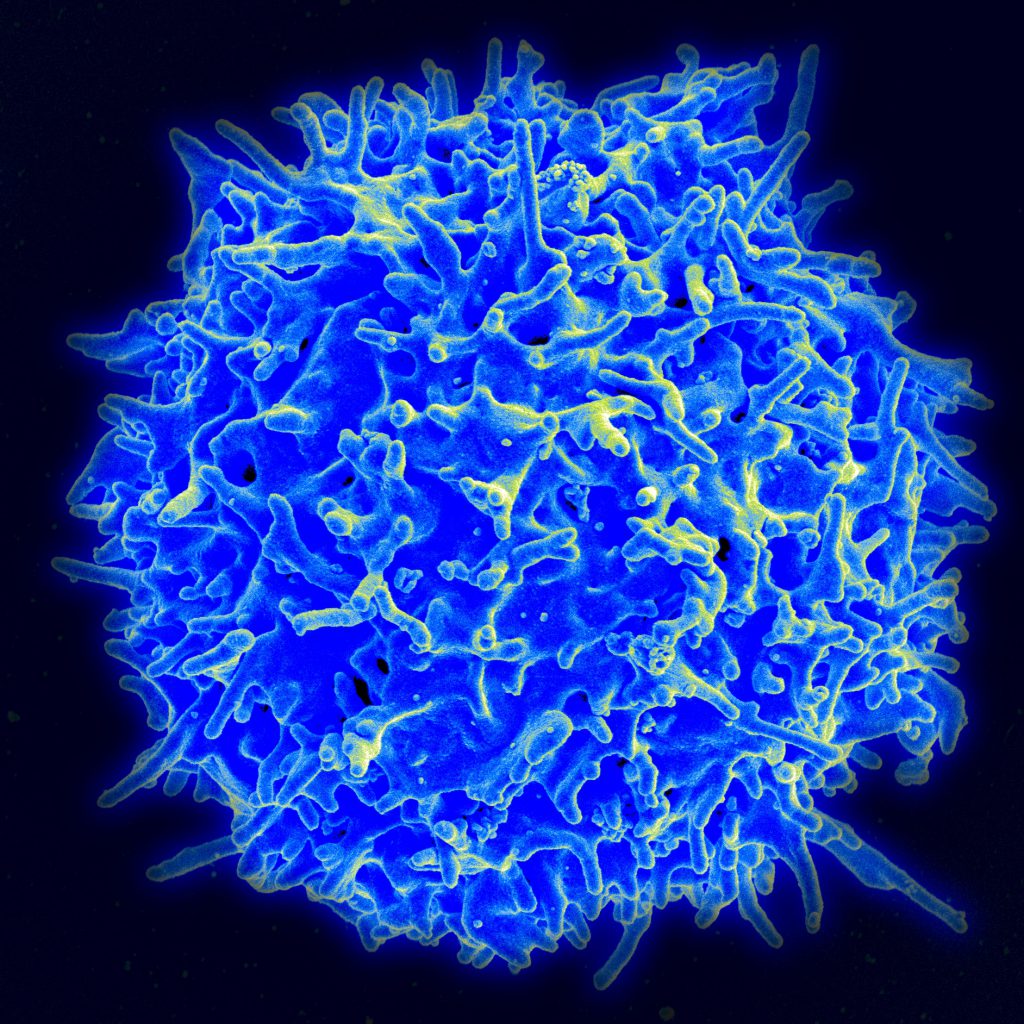 Immunotherapy