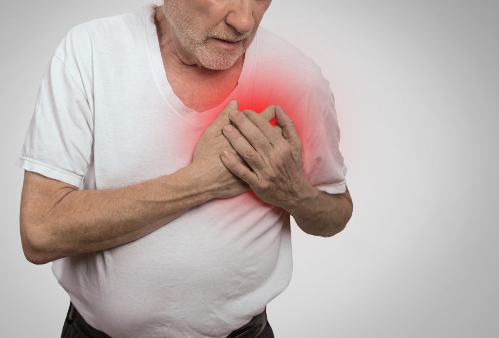Cardiac Event