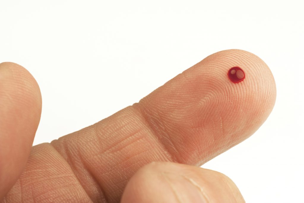 Blood Test