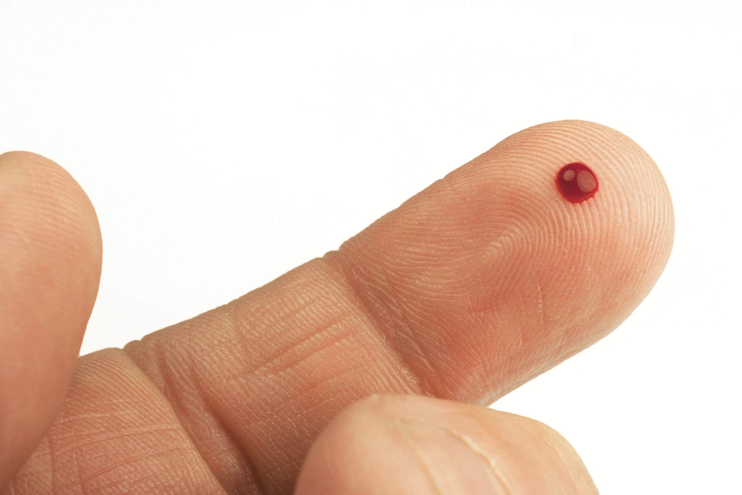 Blood Test
