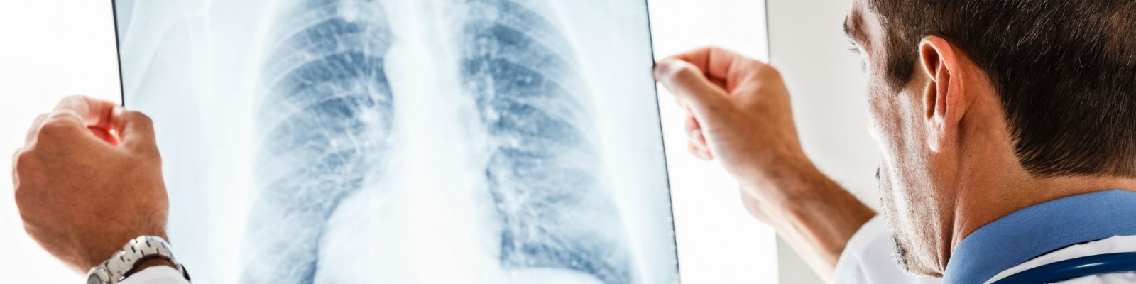 Radiography
