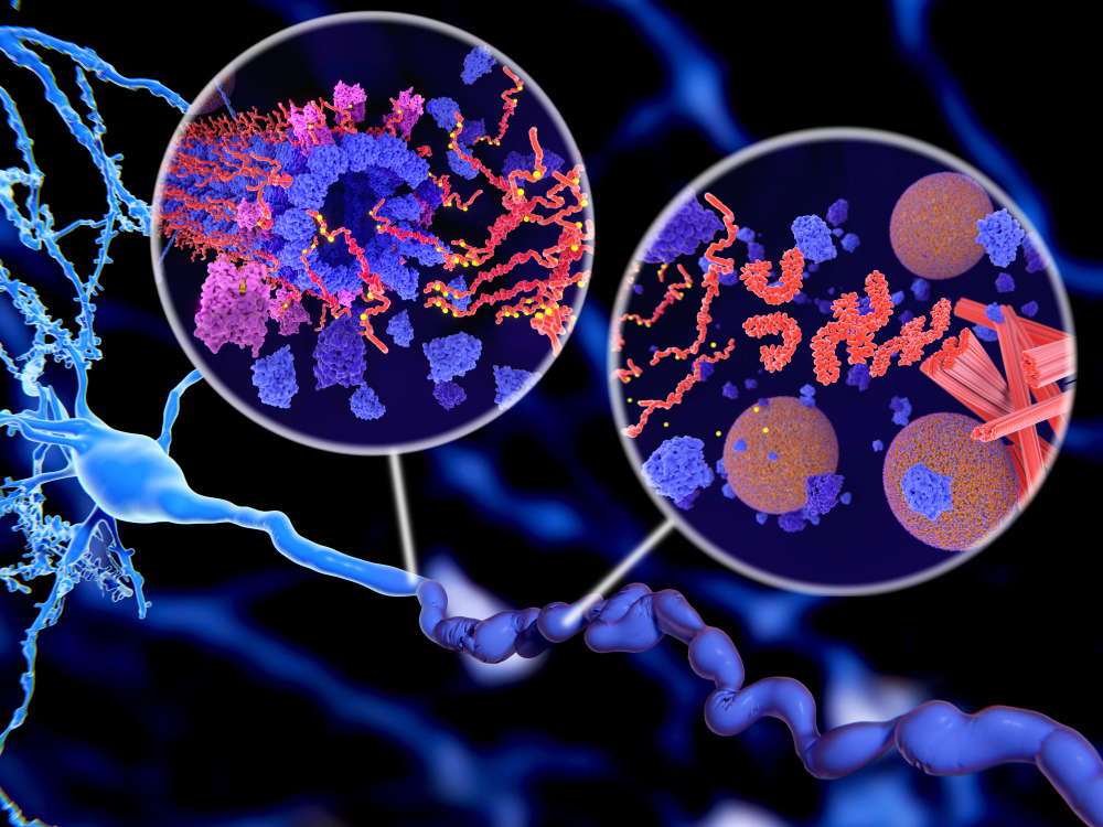 Tau proteins, phosphorylated and forming neurofibrillary tangles in Alzheimer's Disease schematic