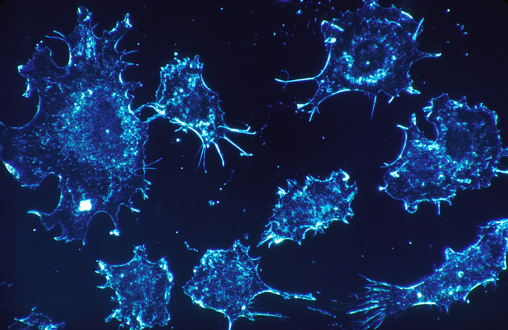 Cancer cells scan electron