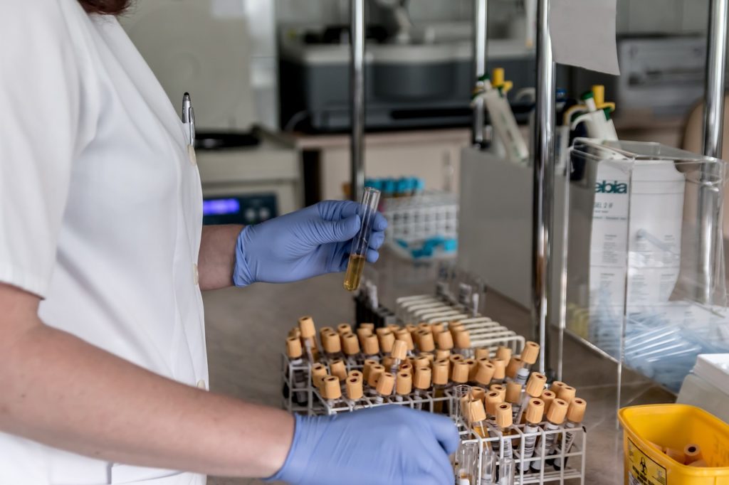 Laboratory blood samples analysis with lab tech