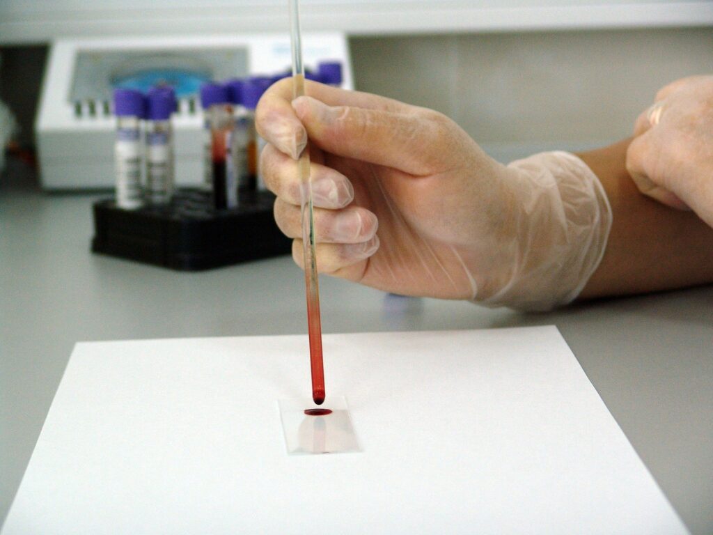 COVID-19 T Cells