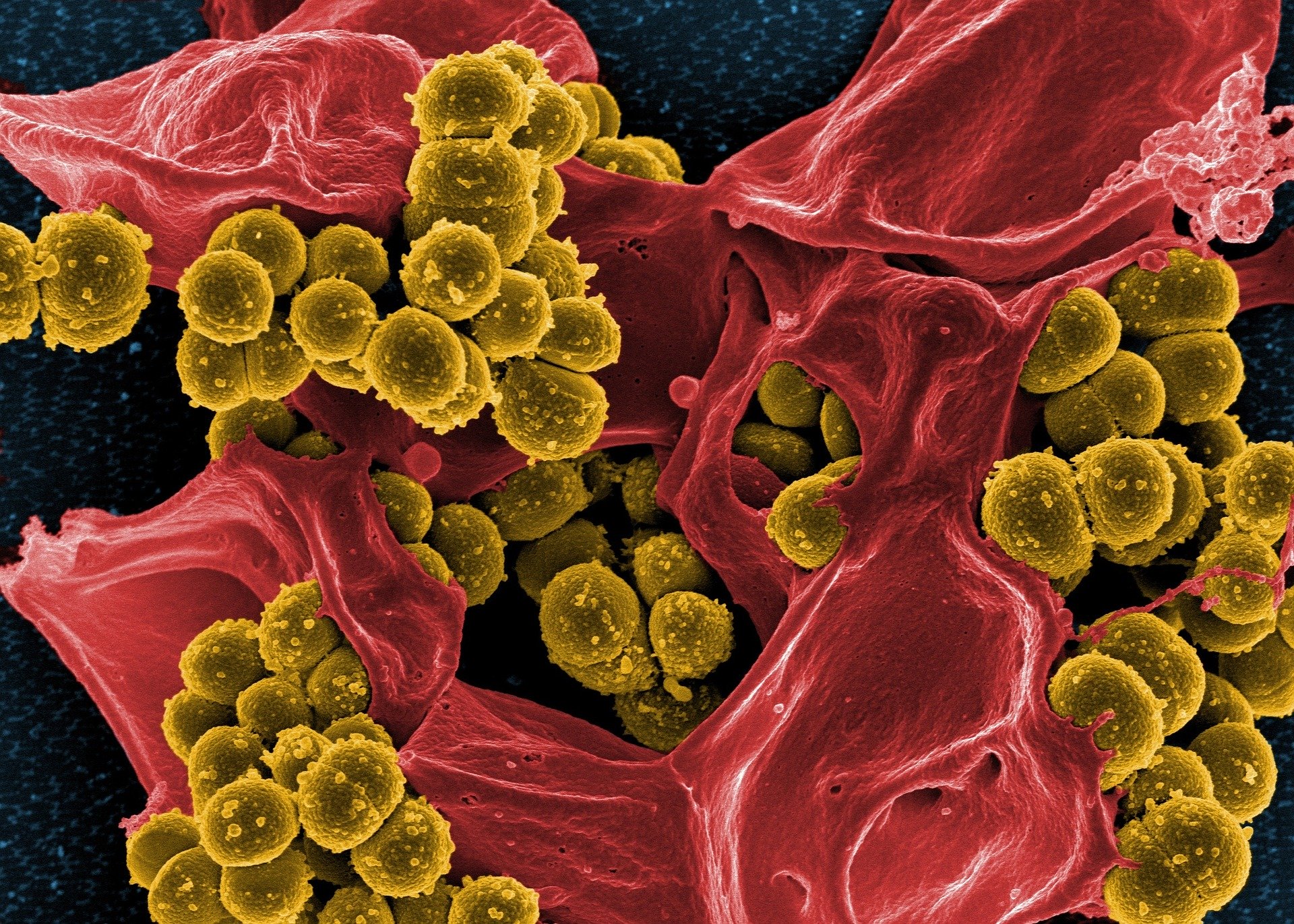 Tumor microbiome