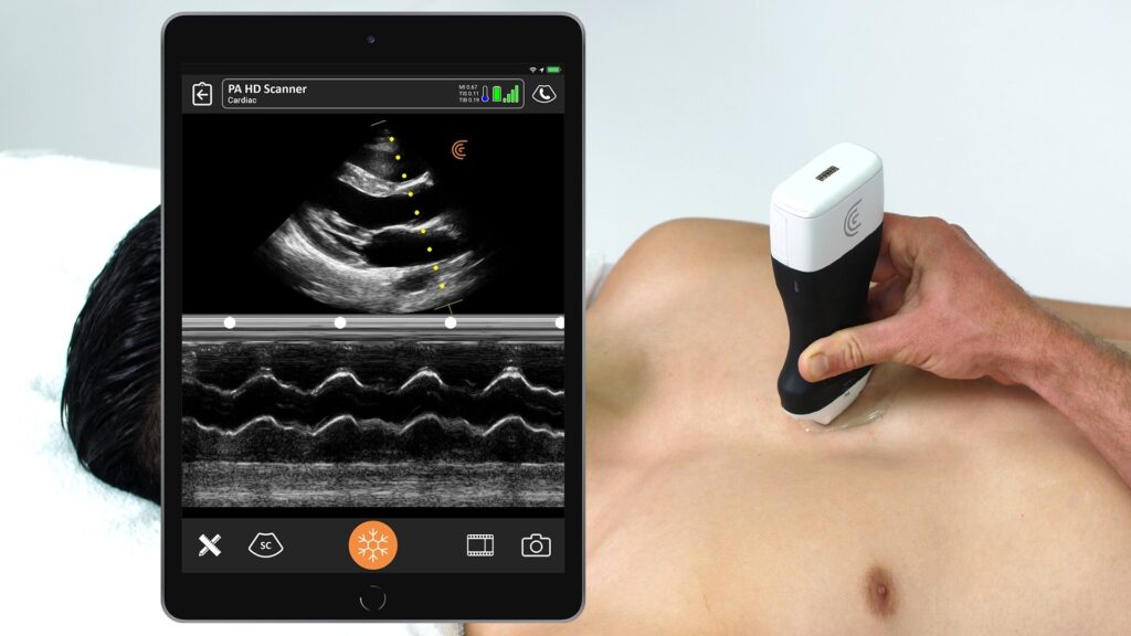 Cardiac ultrasound