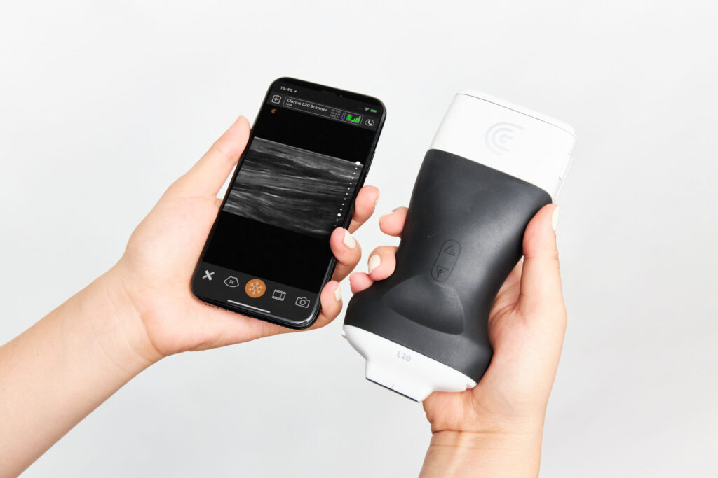Handheld ultrasound
