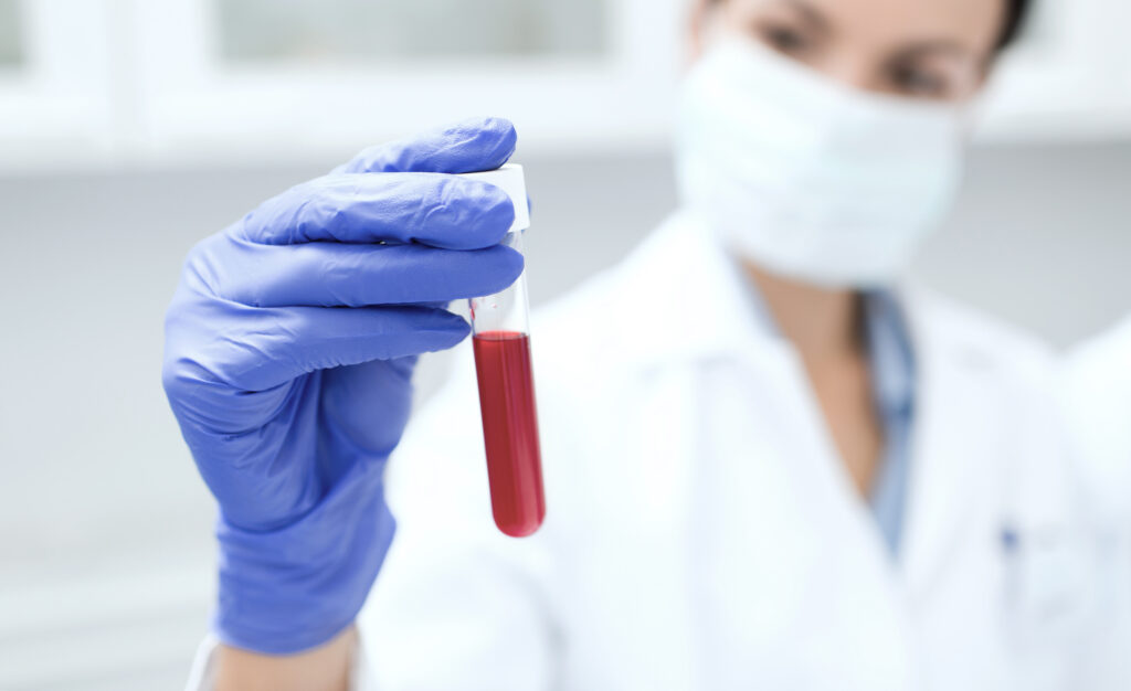 Liquid Biopsy