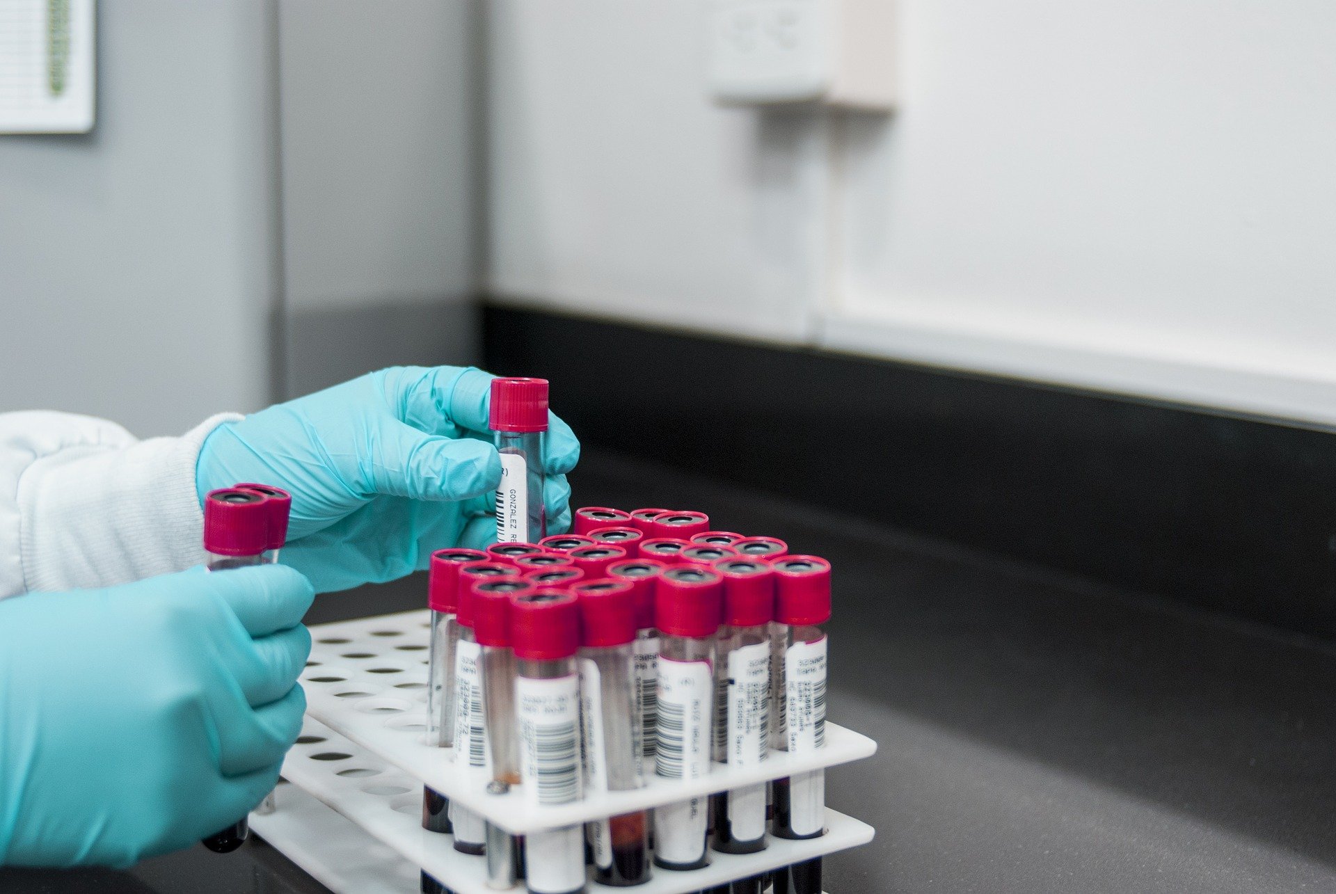 Clinical samples