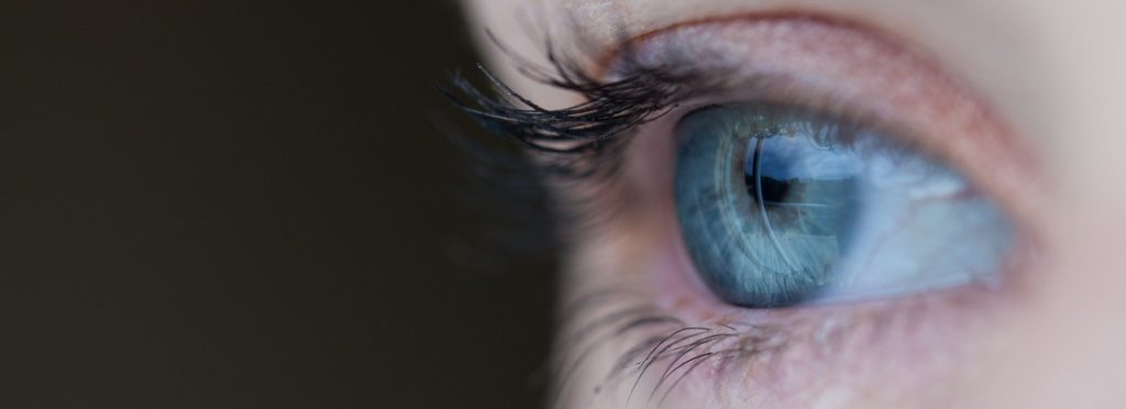 Eye color variation