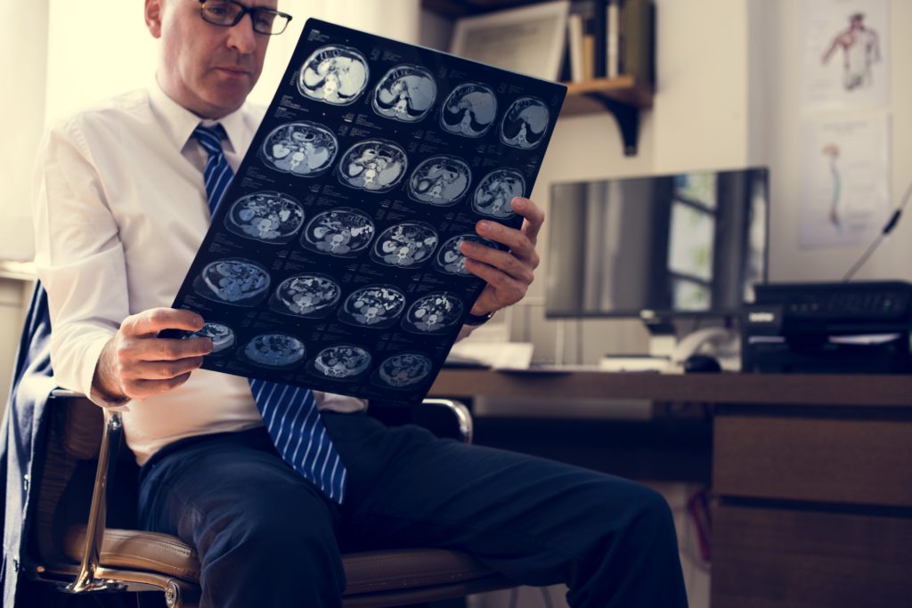Brain CT Scan