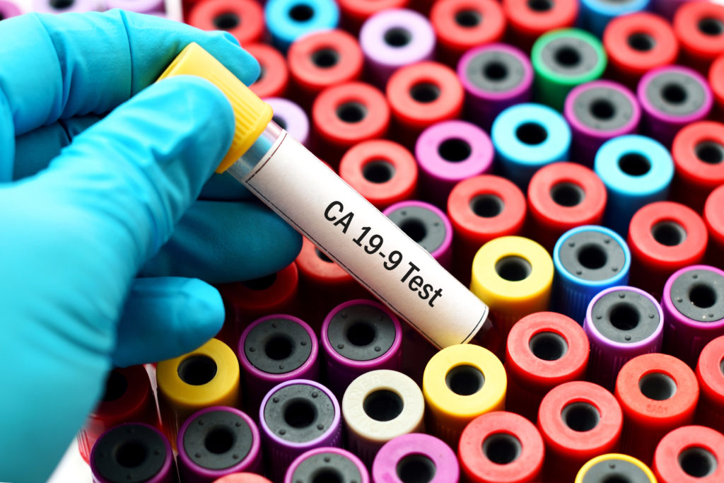 Immunovia blood test