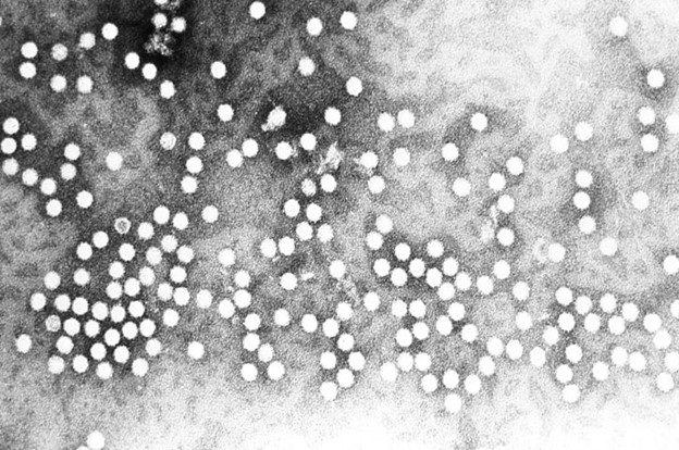 Monkeypox