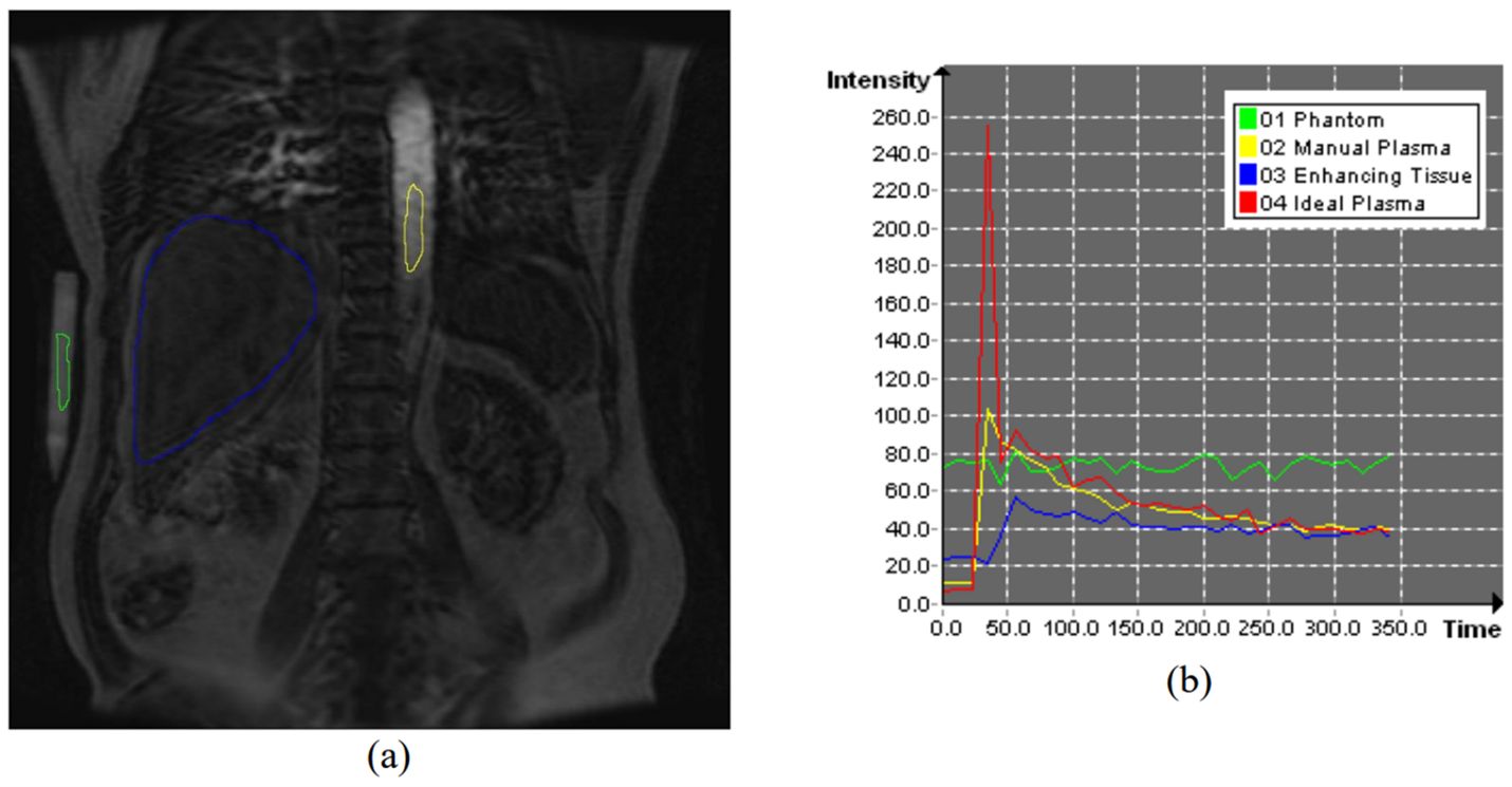Perfusion MRI & Perfusion Imaging