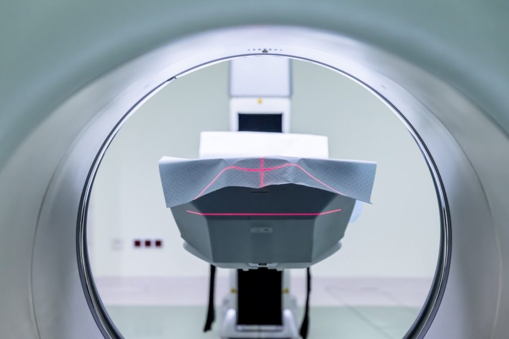Perfusion MRI and Other Perfusion Imaging Techniques