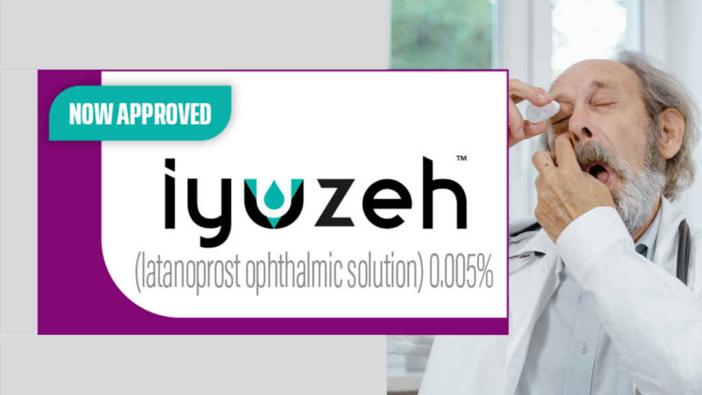 Iyuzeh