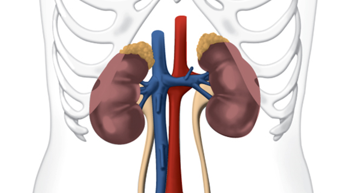 Jesduvroq (daprodustat) is FDA Approved for Anemia due to Chronic Kidney Disease for Adults on Dialysis