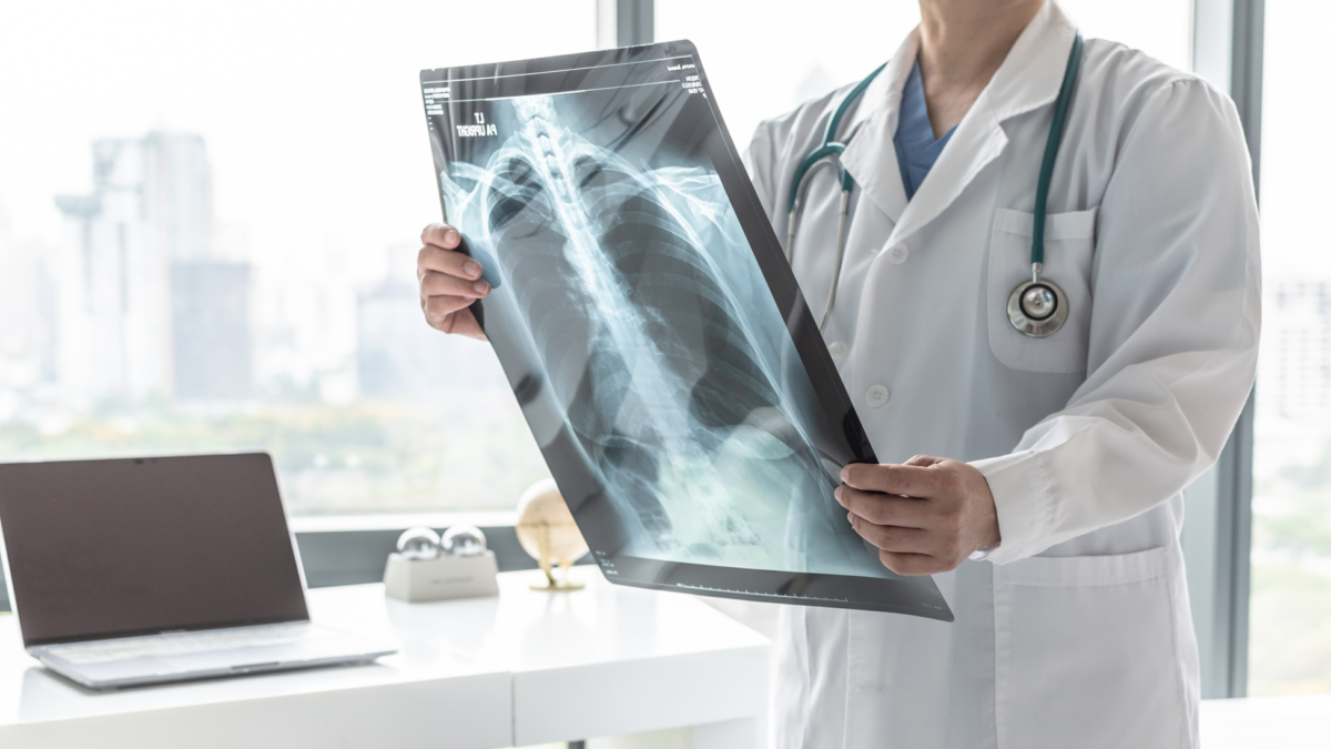 Clinical trials for pulmonary fibrosis