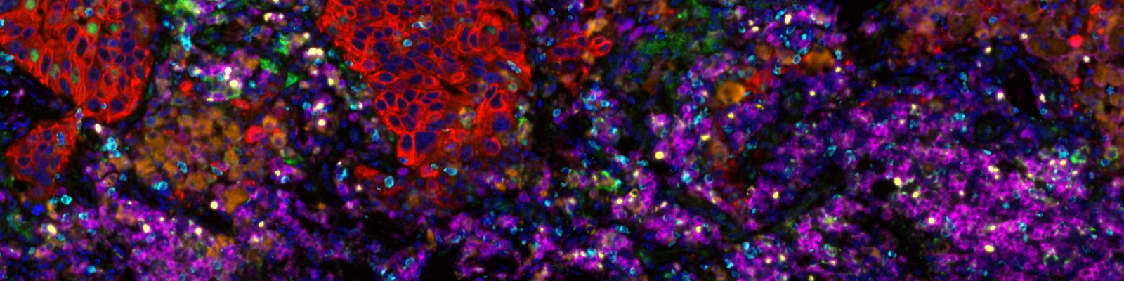 LuCa331-CD4-IC-6Plex-1_Scan1_composite_image
