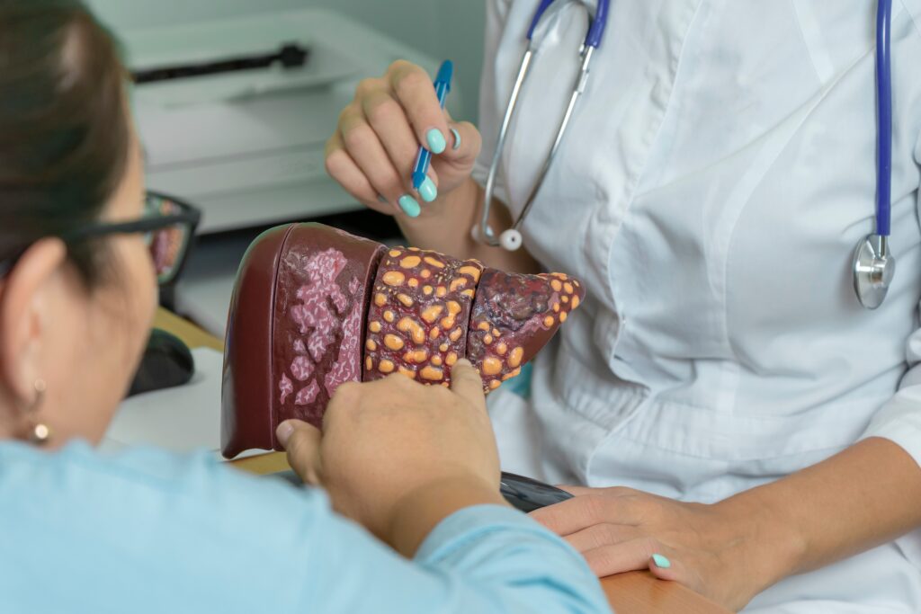 Iqirvo, Elafibranor, Primary Biliary Cholangitis, Chronic Liver Disease, Liver Disease
