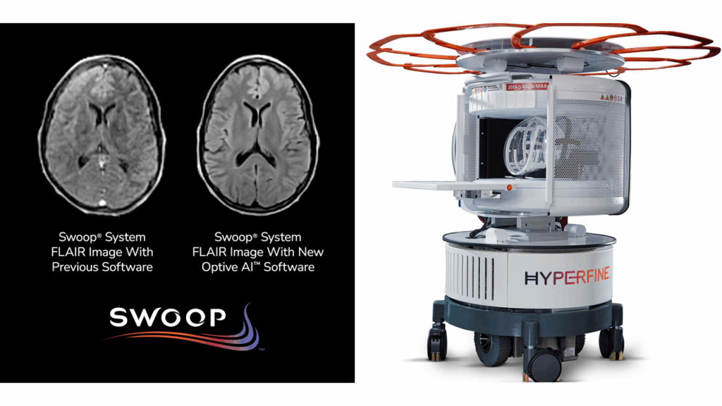 Optive AI, swoop, portable mri, portable mri machine, hyperfine, swoop portable mri system, swoop portable mri imaging system, swoop system, Neuroimaging, MRI, magnetic resonance imaging, Brain Scan