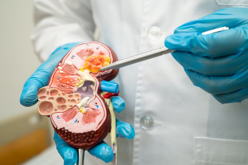 Sibeprenlimab