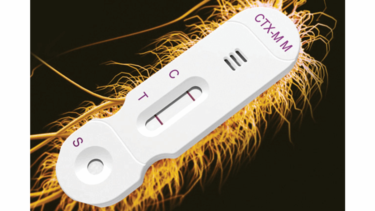 CTX-M, lateral flow immunoassay, hardy diagnostics, Enterobacterales, extended-spectrum beta-lactamases