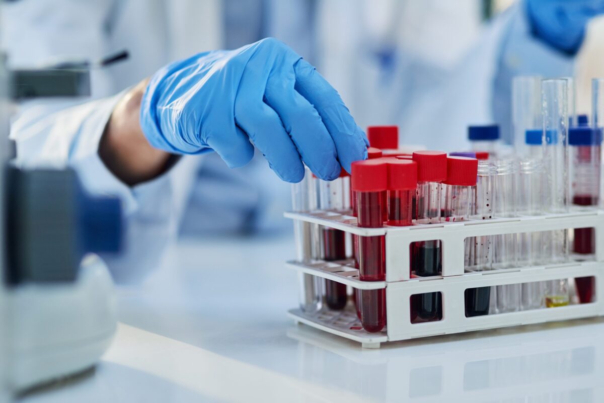 Top 10 Best-Selling Hematology Drugs to Watch in 2025