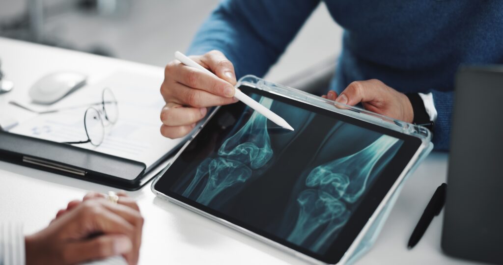 Prolia and Xgeva Biosimilars