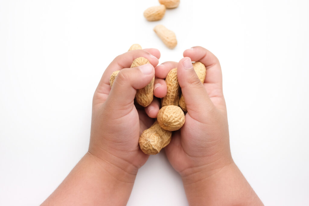 Viaskin Peanut Patch